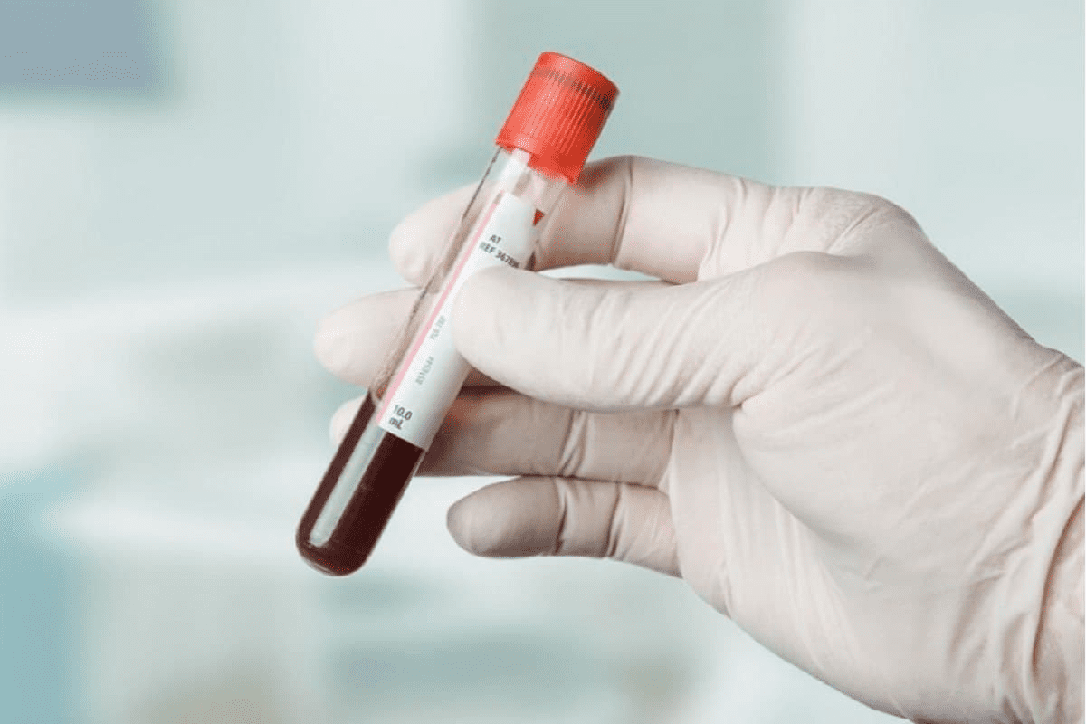 The Misconception of Stage 1 leukemia symptoms: A Clarification