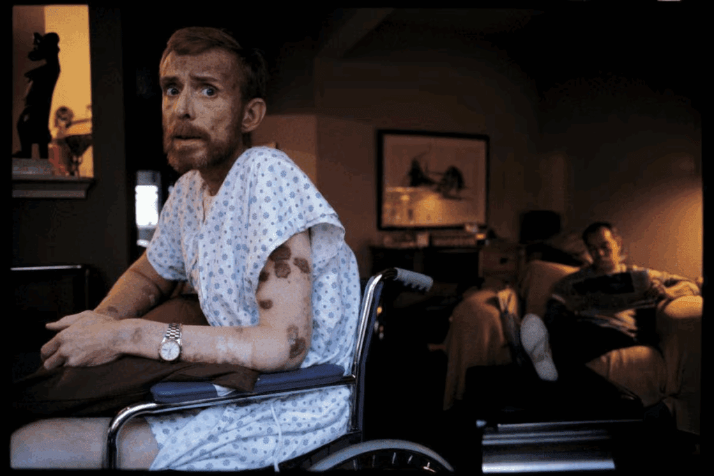 Sarcoma Cancer: A Serious But Treatable Disease