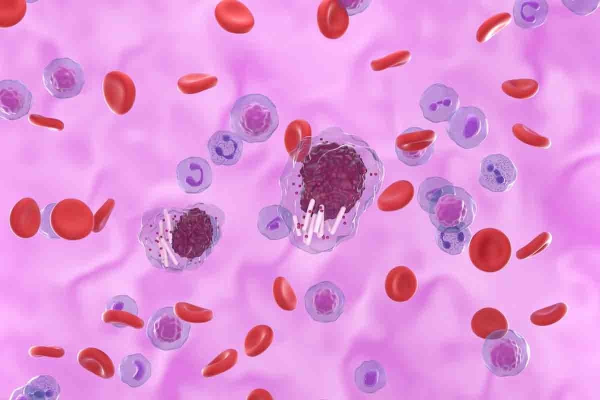 5 Critical Things to Know About Acute Leukemia for Faster Care