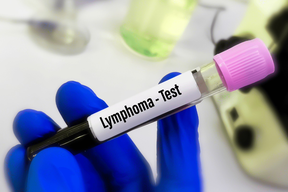 Difference Lymphoma Solid Tumors