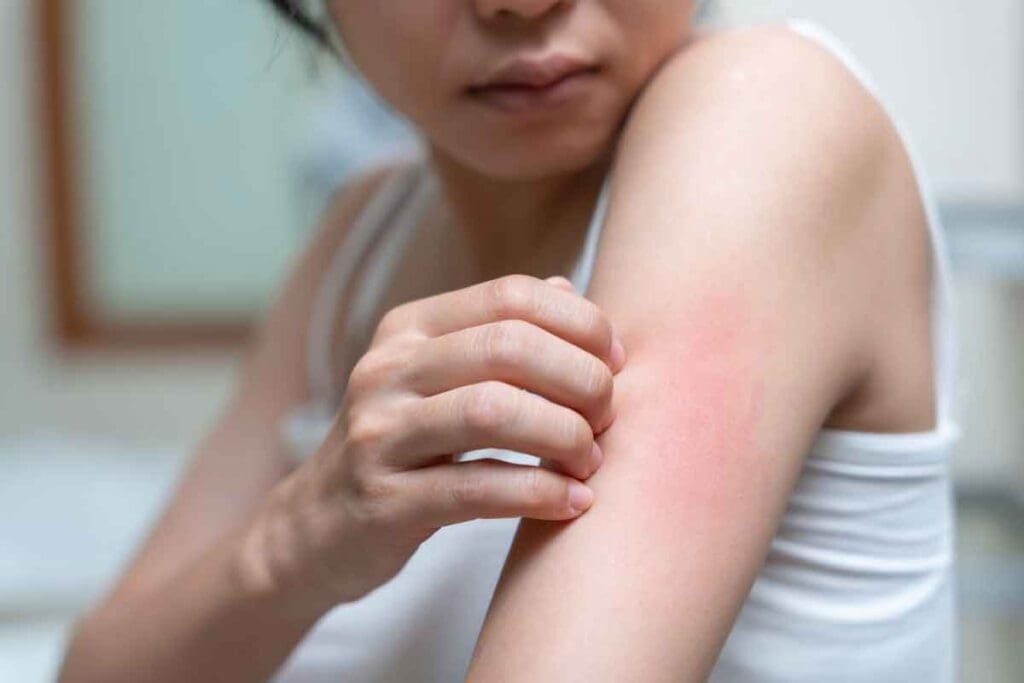 10 Key Signs of Anemia Skin: What Low Iron Can Do and How to Check 1 10 Key Signs of Anemia Skin: What Low Iron Can Do and How to Check