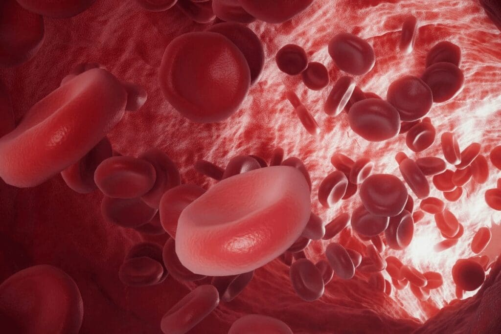 How Can You Die From Anemia? Causes, Risks, and Prevention Explained 1 How Can You Die From Anemia? Causes, Risks, and Prevention Explained