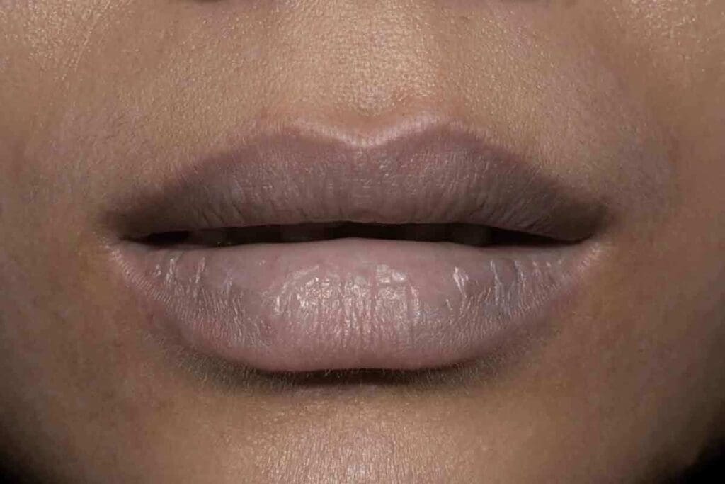 Why Do Lips Turn Pale: Understanding Anemia Lips? 2 Why Do Lips Turn Pale: Understanding Anemia Lips?