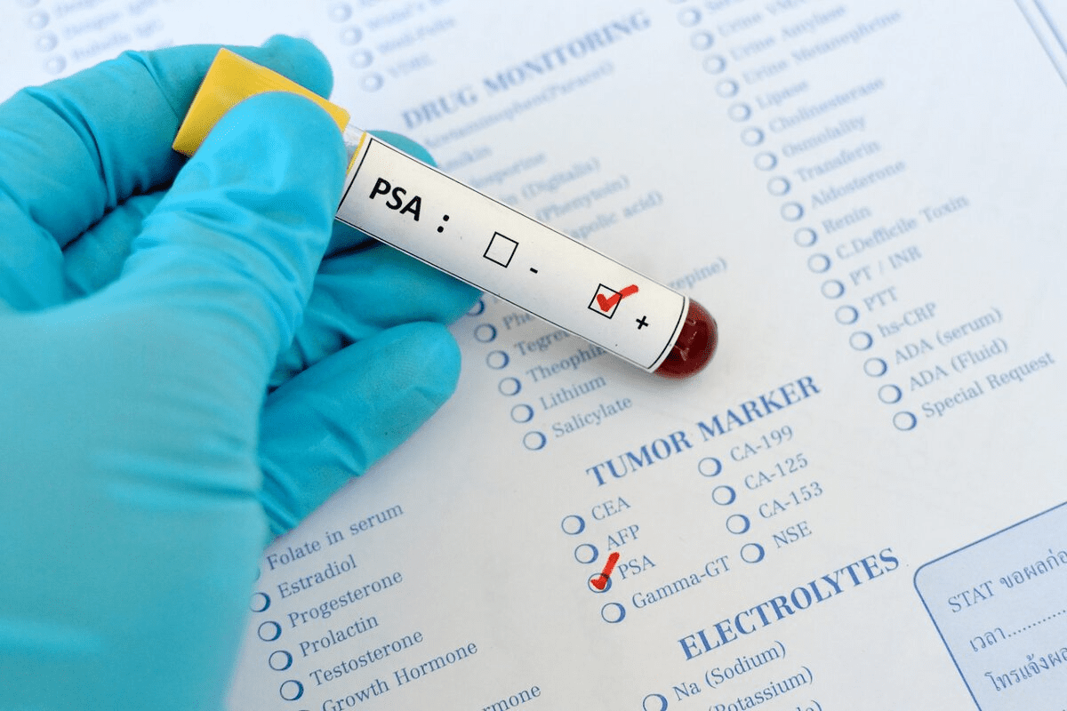 PSA Test: Crucial Prostate-Specific Antigen Facts