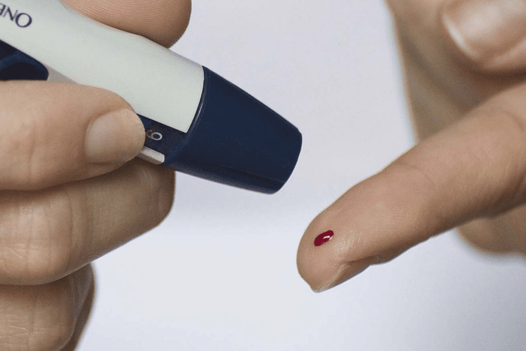 Diabetes and Sleep: You Need to Know 1 Diabetes and Sleep: You Need to Know