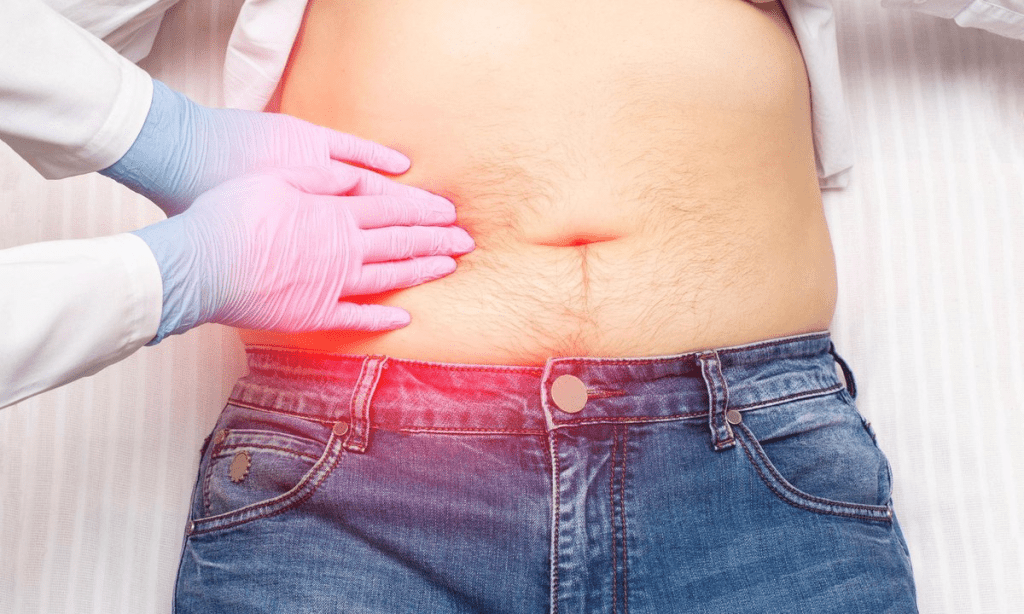 Urethroplasty Hospital Stay: Fast Facts on Duration