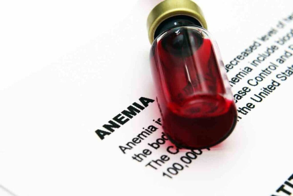 8 Essential for Diagnosing Anemia of Chronic Disease Lab Results