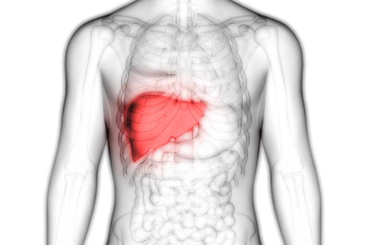 What Is A Cancerous Tumor In The Liver Called? Liver Scarring Name