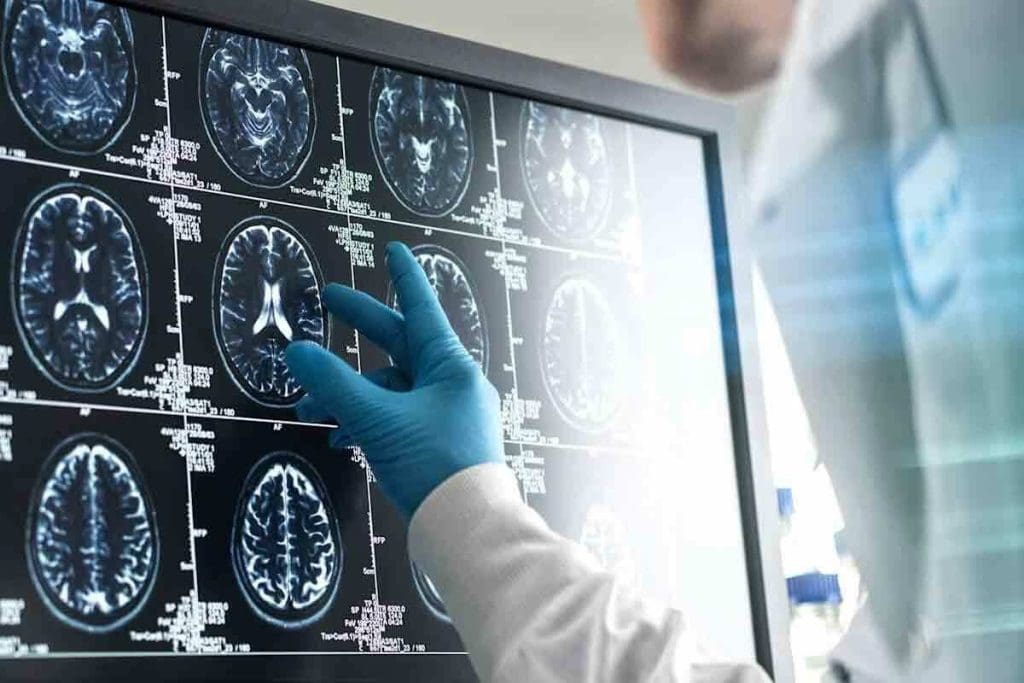 Can Brain Tumor Be Cured by Medicines?