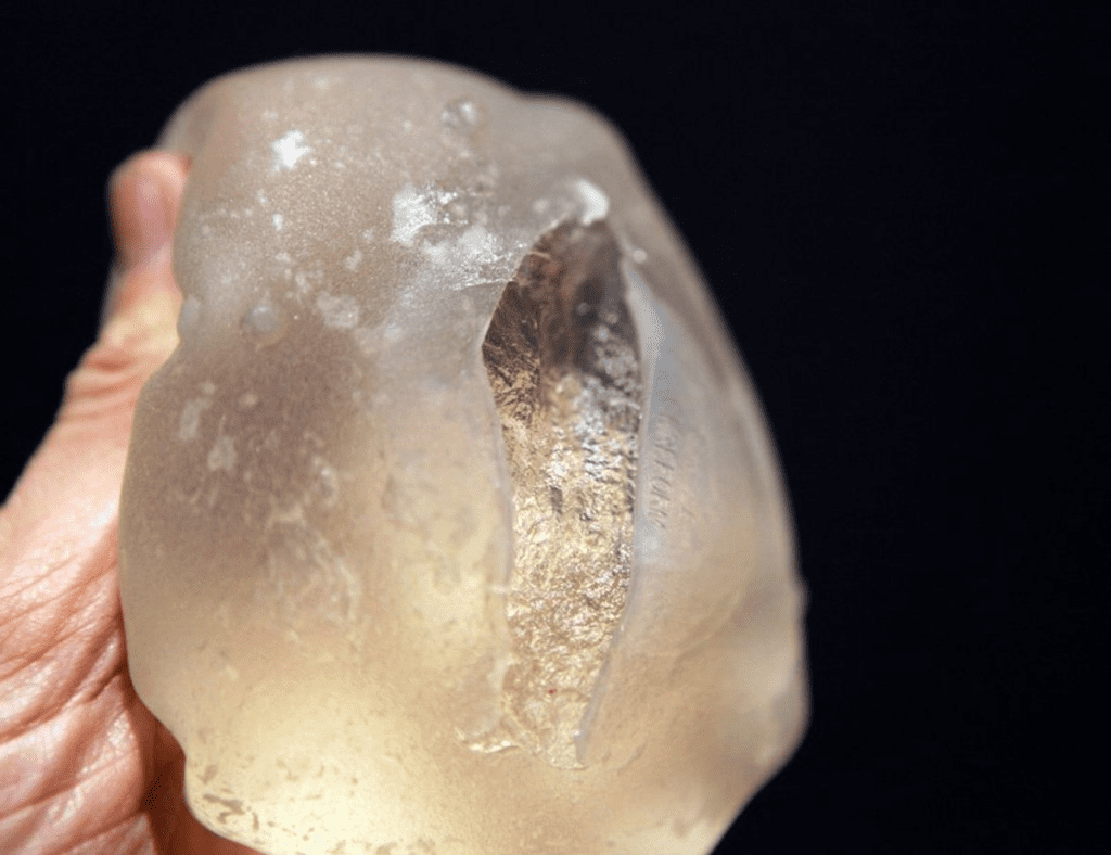 Penile Implant Removal: The Shocking Facts 2 Penile Implant Removal: The Shocking Facts