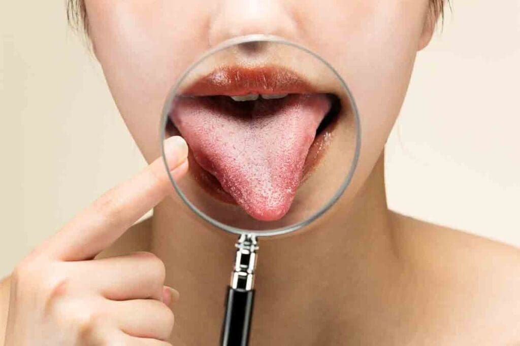 9 Key Signs of Pernicious Anemia Tongue: Pictures, Glossitis, and More
