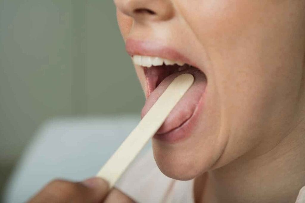 Iron Deficiency on Tongue: 7 Key Symptoms and Signs to Watch For 2 Iron Deficiency on Tongue: 7 Key Symptoms and Signs to Watch For