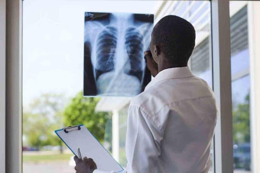 How Long Does Recovery from a Pulmonary Embolism Take and What Affects It? (lung clot recovery time)

