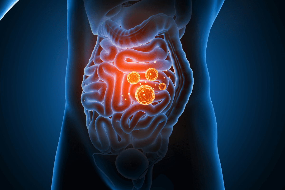 Symptoms of Digestive Disorders to Watch For