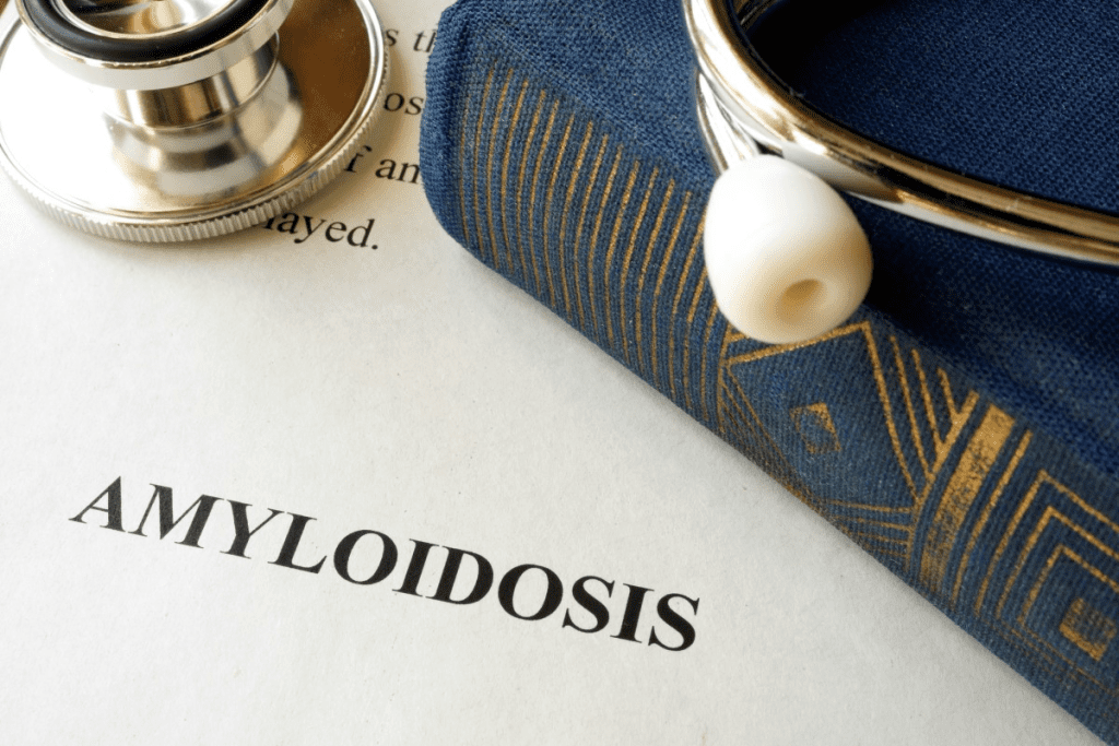 Gastrointestinal Amyloidosis: What to Know