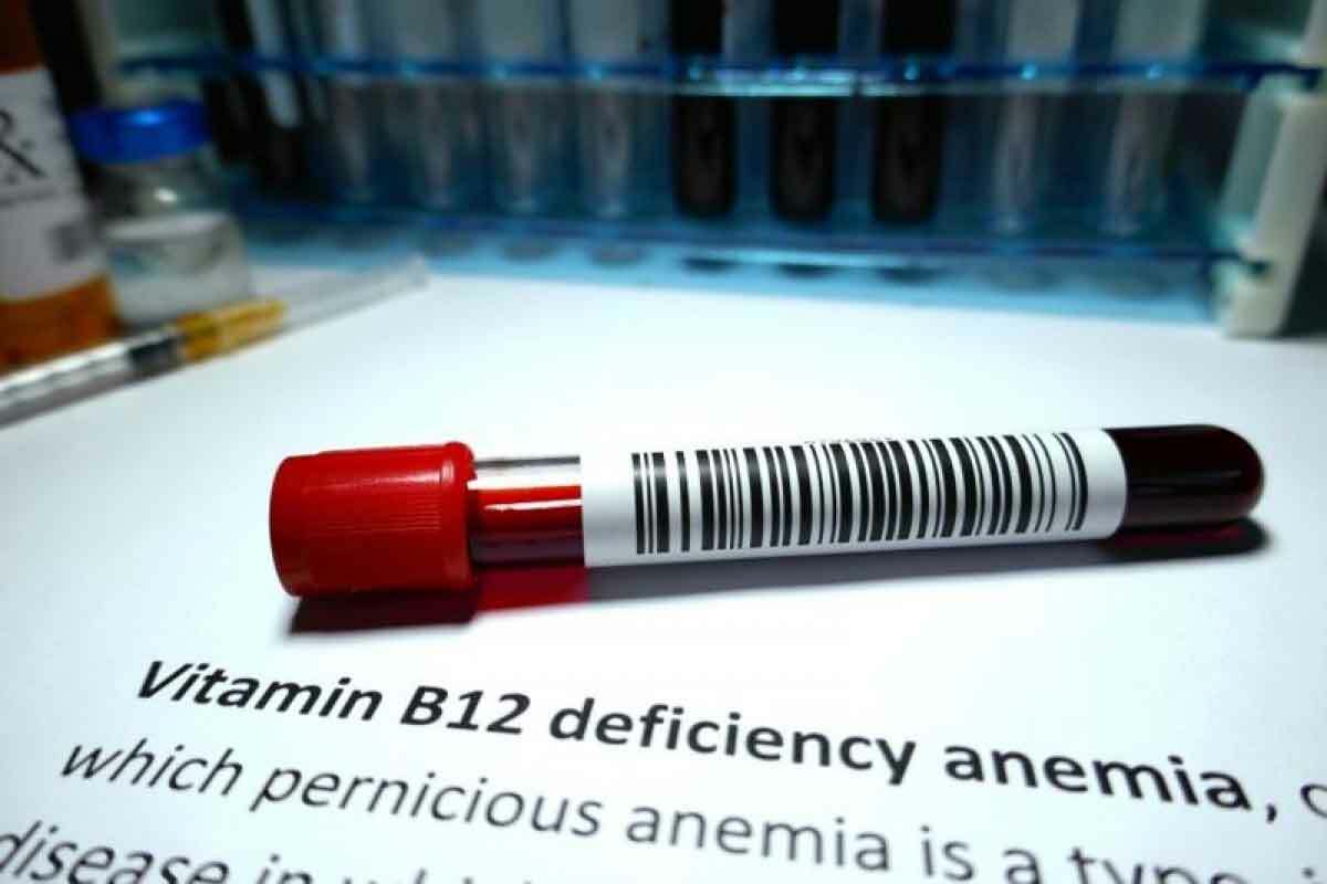 What are the main differences between vitamin B12 and folate deficiencies? Vitamin B12 and folate deficiencies show different signs and lab results. B12 deficiency can cause nerve problems, but folate deficiency does not. Both can lead to a type of anemia called macrocytic anemia. How do serum vitamin B12 and folate levels help differentiate between the two deficiencies? Low B12 levels in the blood point to B12 deficiency. Low folate levels suggest folate deficiency. But other tests, like MMA and homocysteine levels, are also needed to confirm the diagnosis. What is the significance of elevated MMA levels in B12 deficiency? High MMA levels are a clear sign of B12 deficiency. This is because B12 is needed to break down MMA. This helps tell B12 deficiency apart from folate deficiency. Can both B12 and folate deficiencies cause elevated homocysteine levels? Yes, both B12 and folate deficiencies can raise homocysteine levels. This is because both vitamins help in breaking down homocysteine. But,ighh, homocysteine levels don't point to just one deficiency. What are the common laboratory findings in both B12 and folate deficiencies? Both deficiencies can lead to macrocytic anemia, high LDH, low reticulocyte count, and high RDW. These signs point to a type of anemia but don't single out either deficiency. Who is at risk for B12 and folate deficiencies? Older adults, vegetarians, and people with gut problems are more likely to have these deficiencies. It's wise to screen these groups regularly. How are B12 and folate deficiencies treated? B12 deficiency is treated with B12 injections. Folate deficiency is fixed with oral supplements. It's key to watch how the treatment works and adjust it if needed. What are the possible complications of treating B12 and folate deficiencies wincorrectly Wrong treatment, like using folate for B12 deficiency, can hide symptoms and cause nerve damage. It's vital to diagnose correctly and tailor treatments to avoid harm. How do high vitamin B12 and folate levels affect the diagnosis of deficiencies? High levels of B12 and folate can happen in liver disease or after taking supplements. These findings need to be looked at with the patient's symptoms and other lab results in mind. What is the role of folate and B12 in DNA synthesis? Both folate and B12 are key for DNA making. Without enough of either, DNA synthesis fails, leading to megaloblastic anemia.