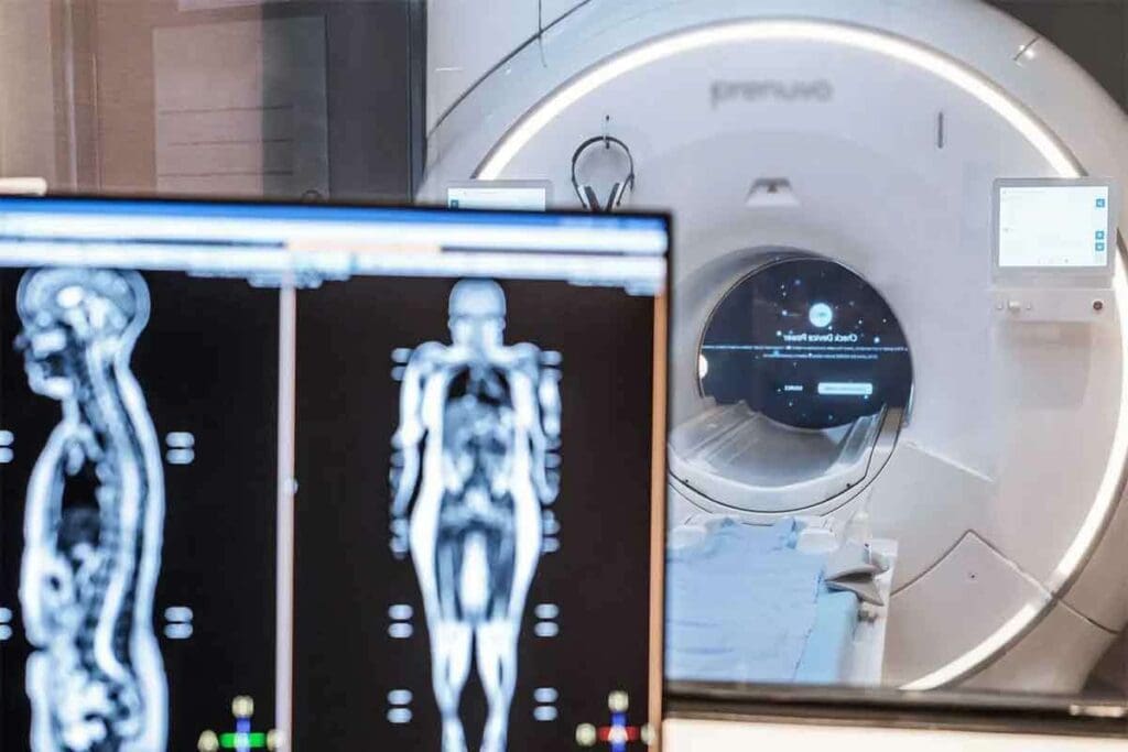 CT Full Body: The Ultimate Guide to This Amazing Scan