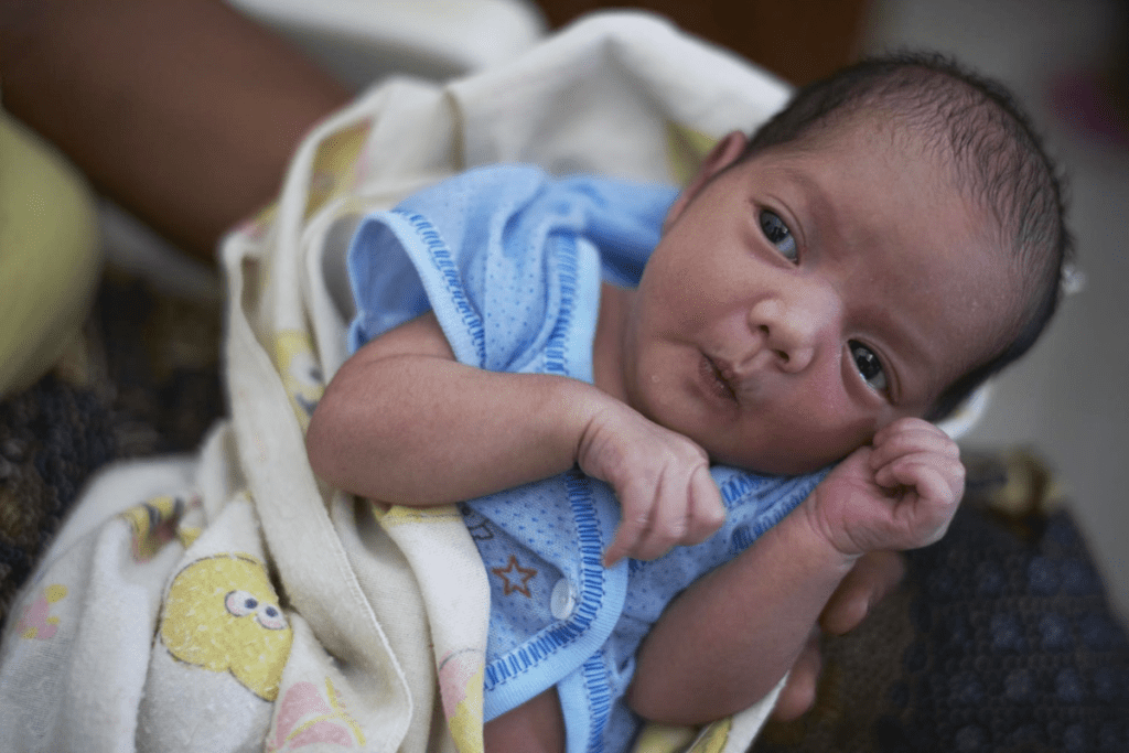 Congenital Malformations: Rare Small Intestine Disorders