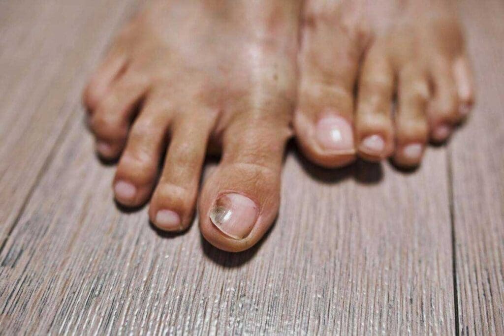 8 Warning Signs of Blood Clots in Your Foot (With Photos & Symptoms)