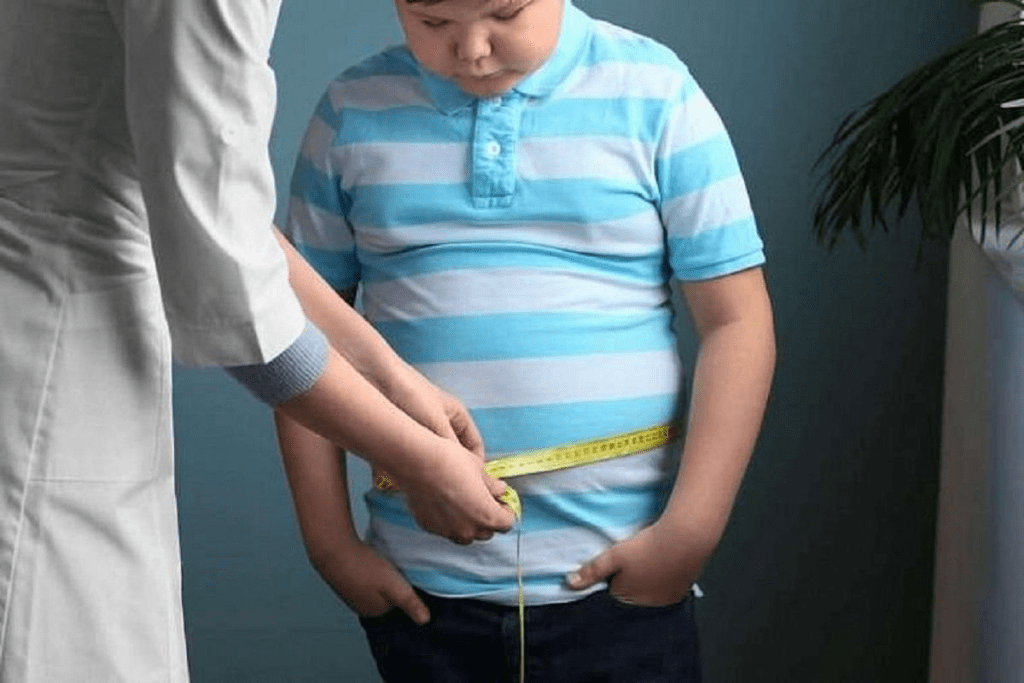 Child Obesity Point: When a Kid Is Considered Obese 2 Child Obesity Point: When a Kid Is Considered Obese