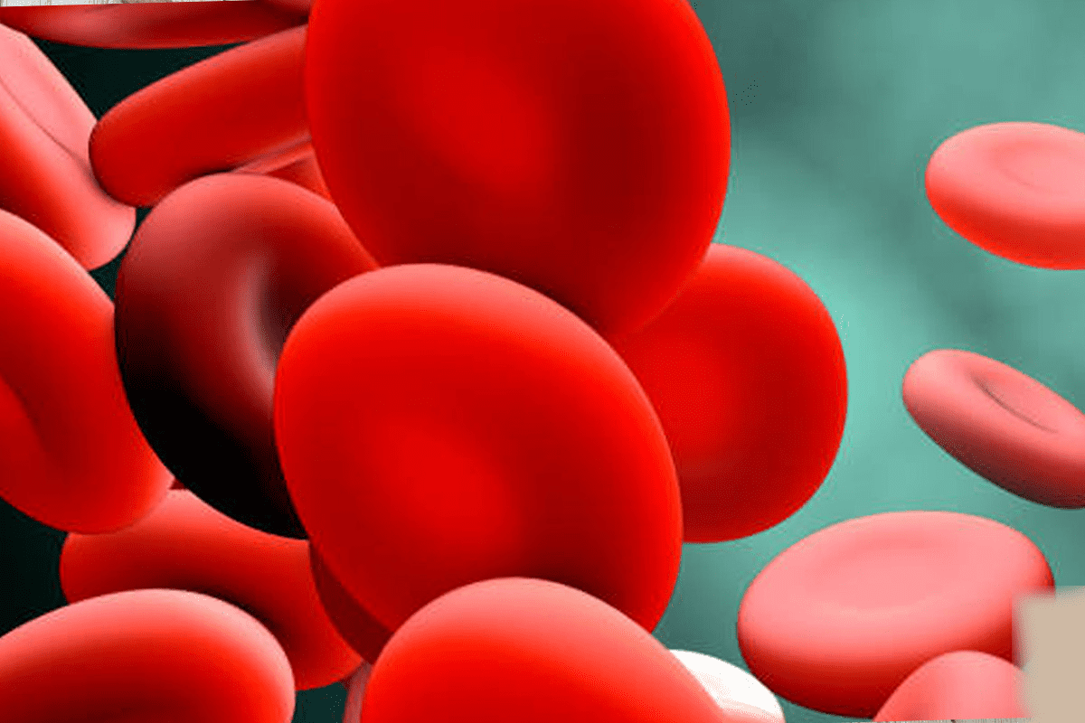Does Leukemia Cause Anemia? Hemoglobin Data