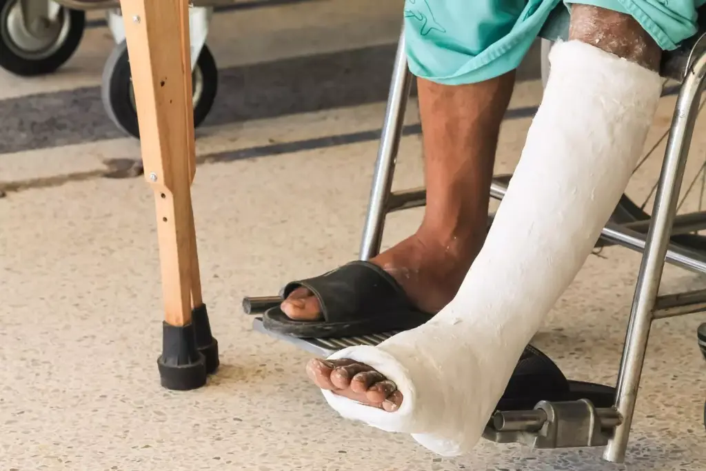 Does a Partially Torn ACL Require Surgery? Understanding Symptoms, Treatment Choices, and Recovery 2 image 40 LIV Hospital