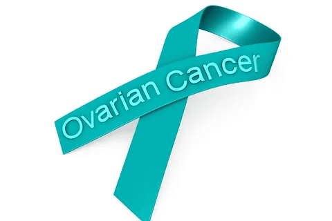 Ovarian Cancer Common Age: Vital Insight