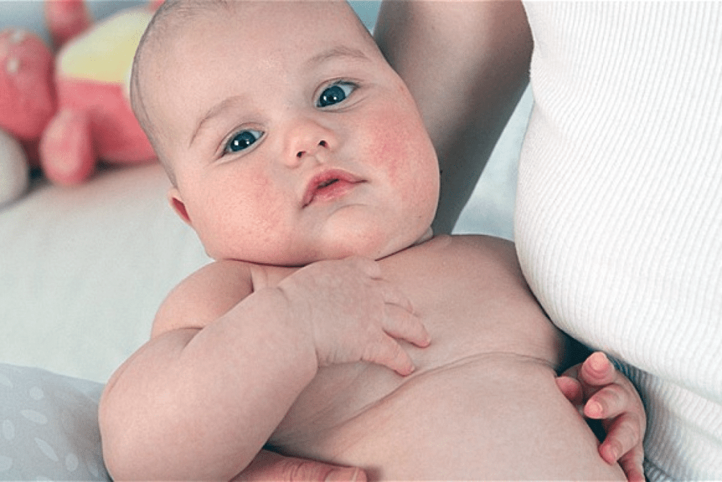 Childhood Obesity: Disorders That Cause It Explained 3 Childhood Obesity: Disorders That Cause It Explained