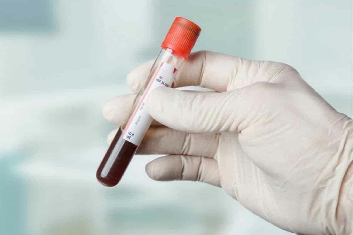 8 Best At Home Blood Tests: Quick, Accurate LabMe CBC & Full Panels