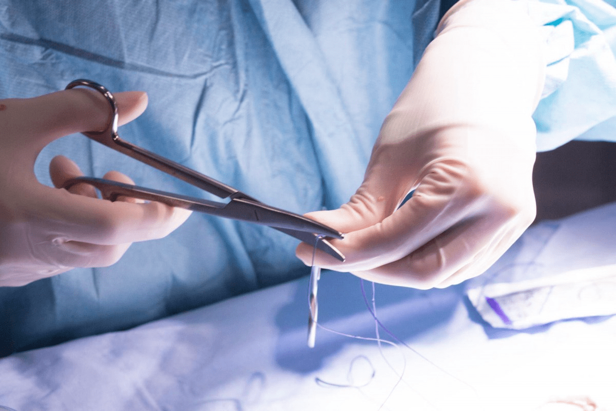 Urethroplasty Aftercare: Crucial Steps After Procedure