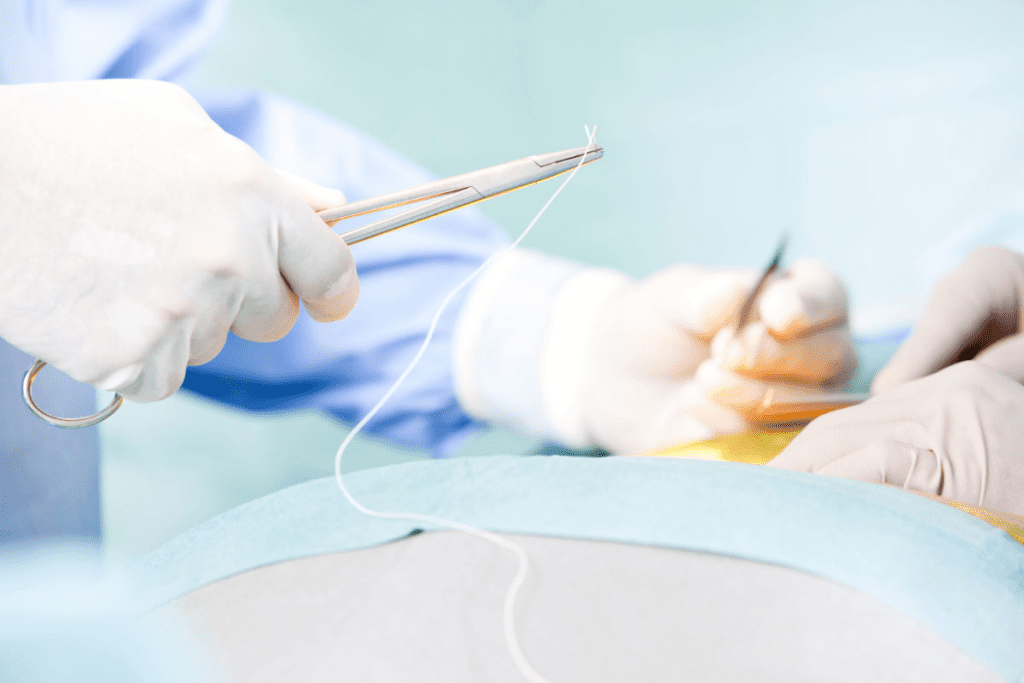 Define Stricture: Negative Effects If Left Untreated