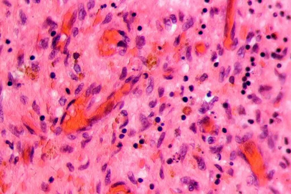 c"What Does a Blood Clot in the Leg Feel Like and Can You Detect Its Movement? What Does a Blood Clot Feel Like"