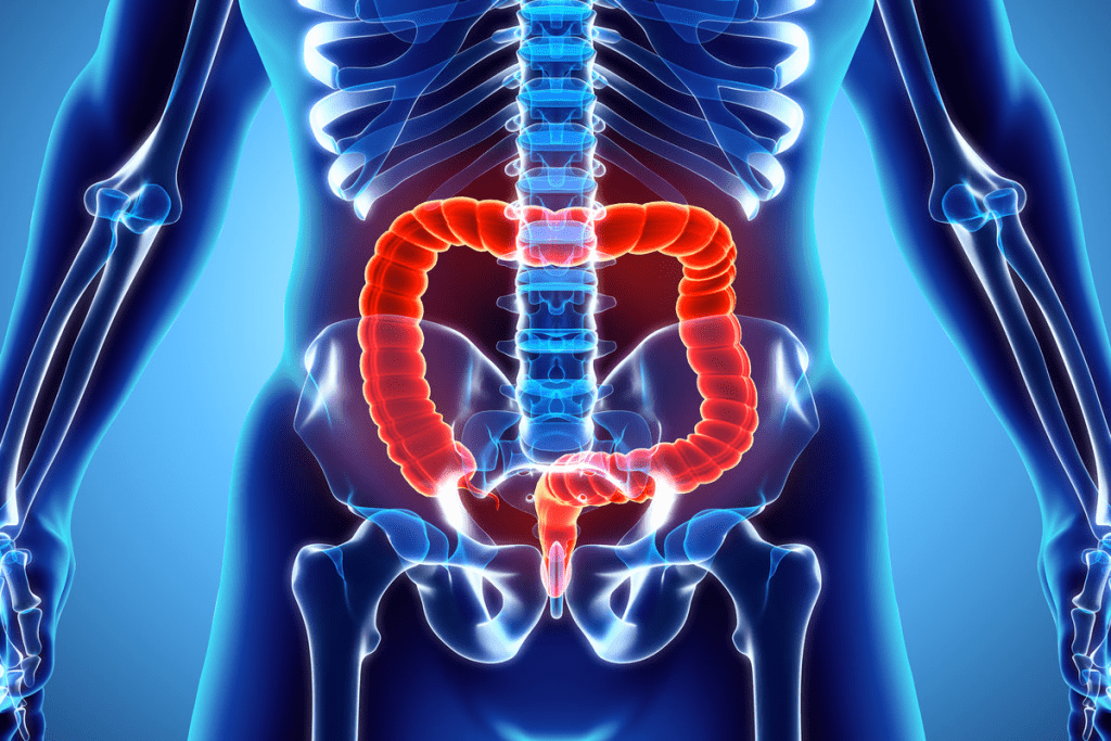  Recognizing Cancer diarrhea symptoms: What to look for.