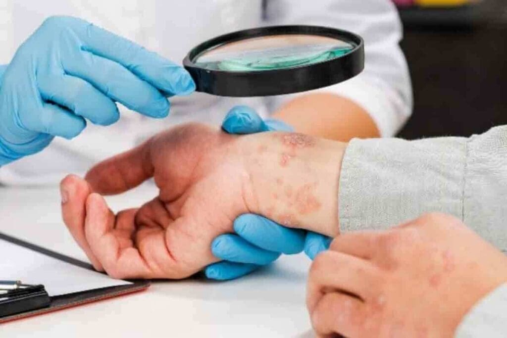 Blood Clot Inside Skin: How to Tell If It’s a Clot or Just a Bruise 2 Blood Clot Inside Skin: How to Tell If It’s a Clot or Just a Bruise