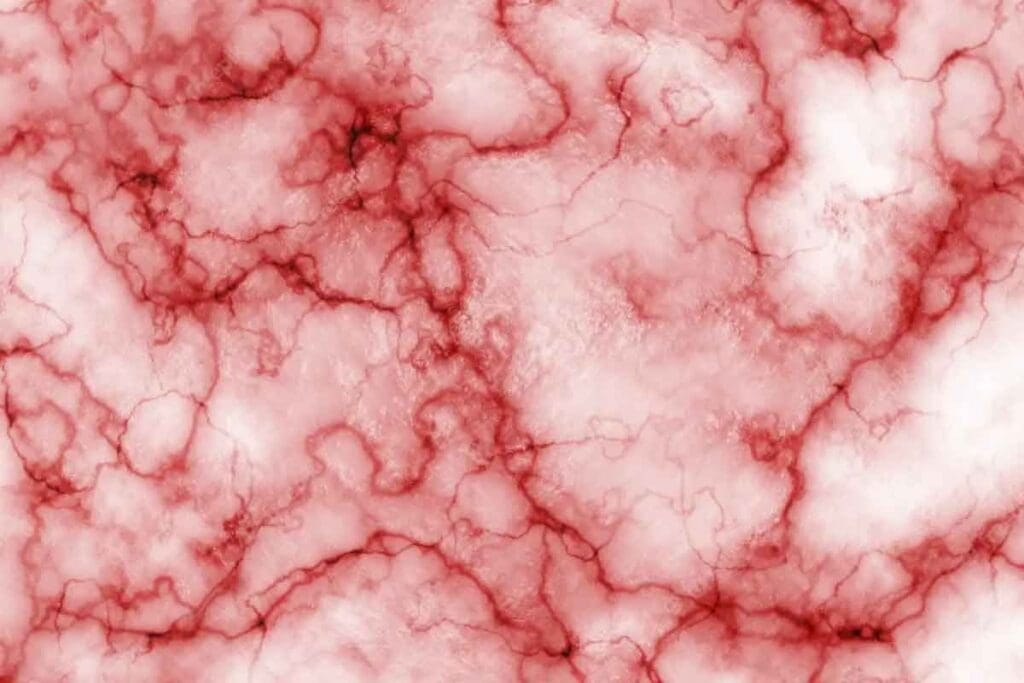 Subdermal Bleeding: 12 Common Causes and Key Symptoms to Know