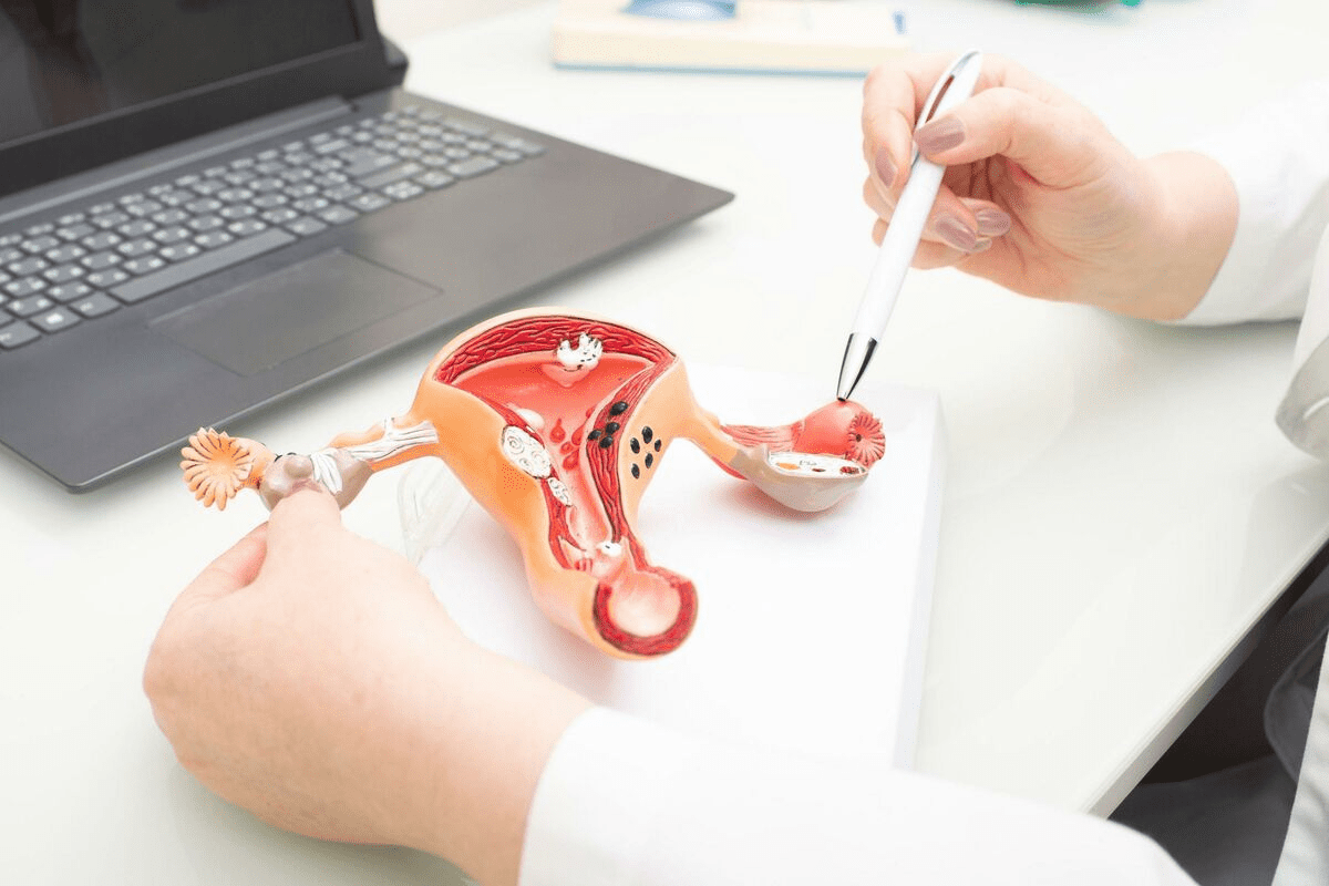 Full Blood Count Ovarian Cancer Detection