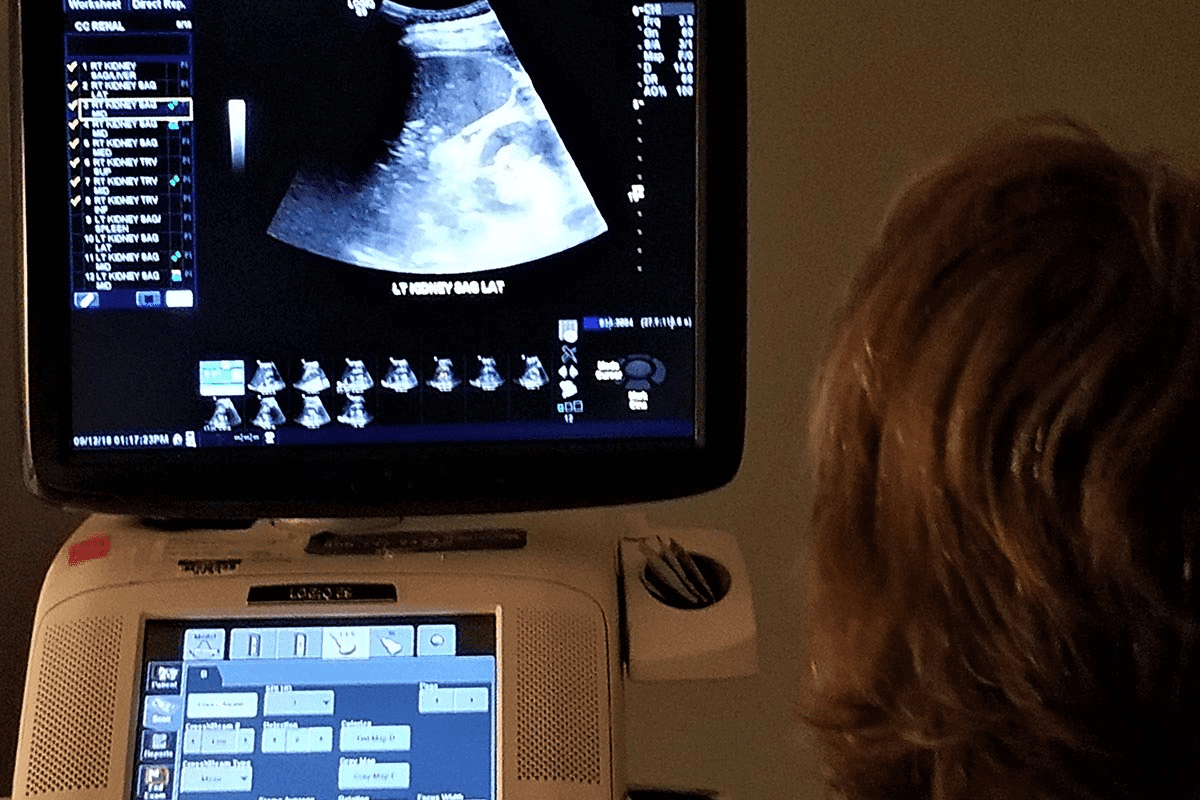 Signs of a bad ultrasound: What they tell you.