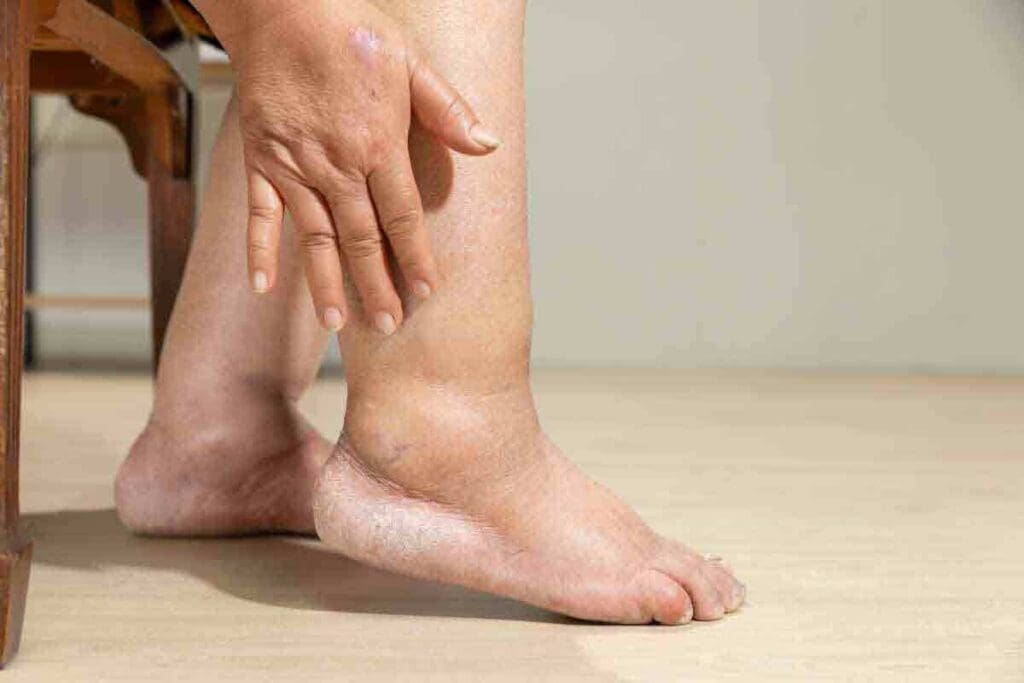 What Kind of Doctor Treats Blood Clots, and How Is Recovery Managed?