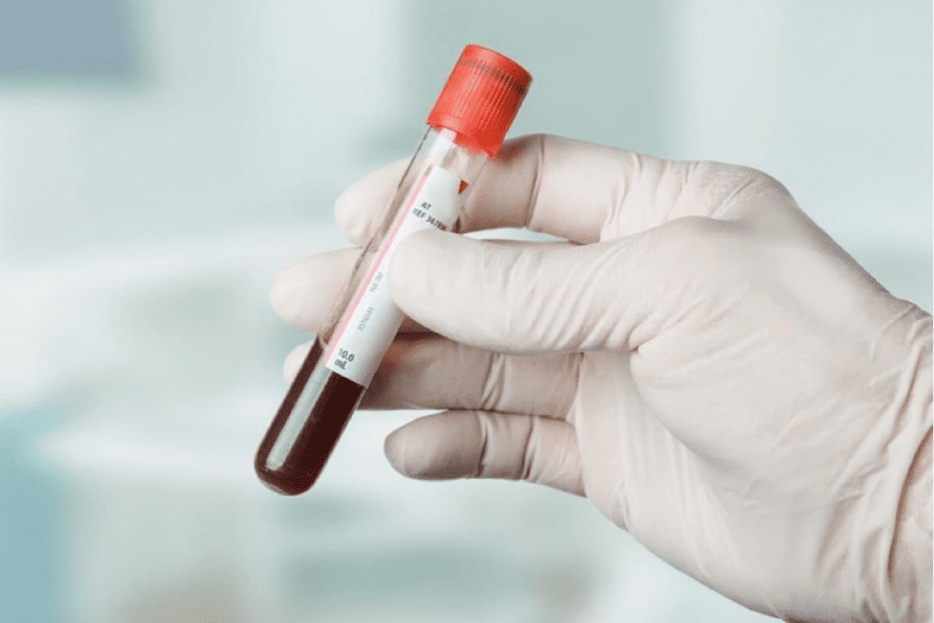 The Key Ovarian cancer blood test for detection.