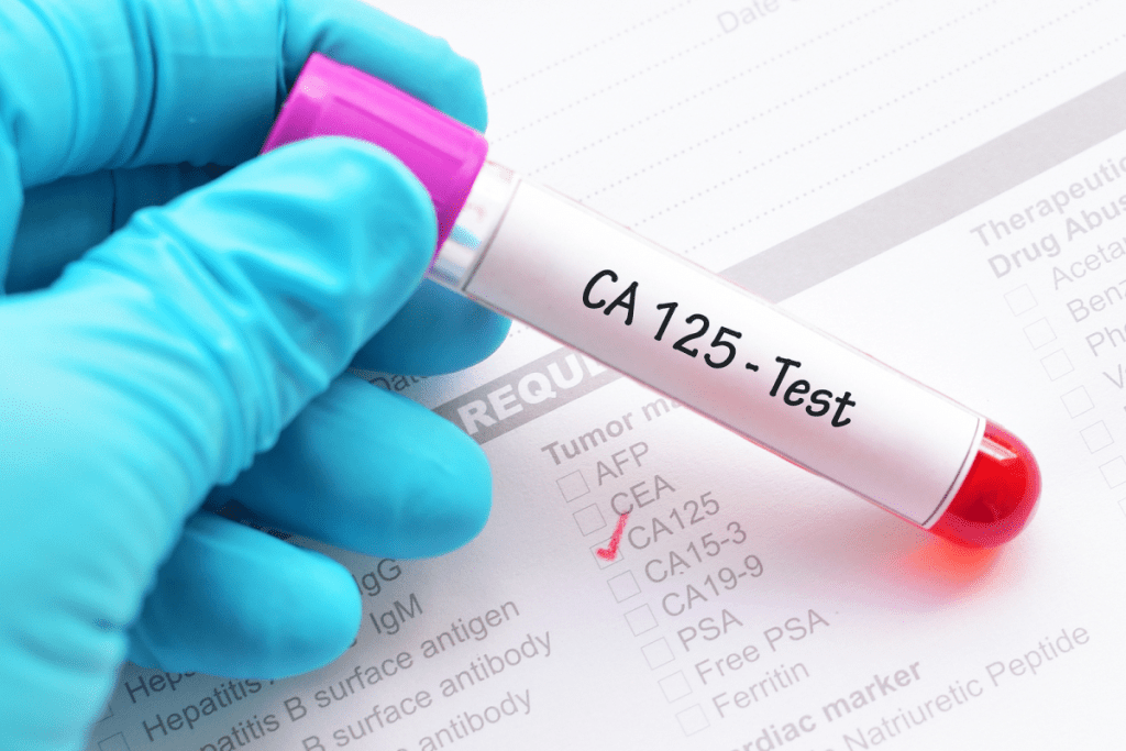 The Key Ovarian cancer blood test for detection.