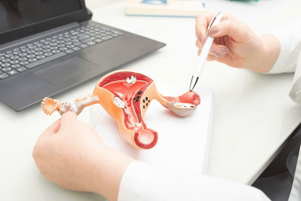 Ovarian Cancer Silent Killer: Hidden Danger