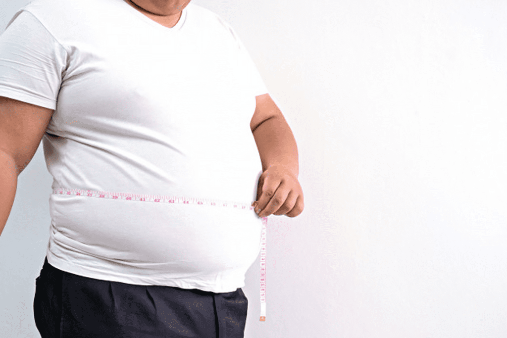 Types of Obesity: Six Shocking Categories Listed