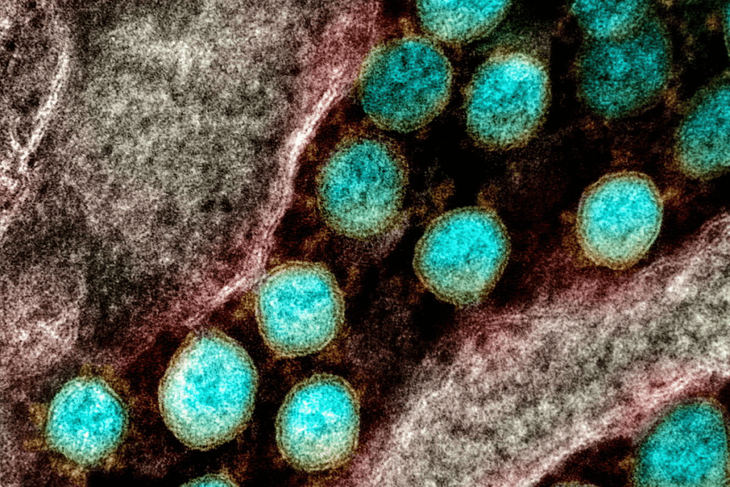 What Deficiency Causes Low Platelets? Crucial Answer