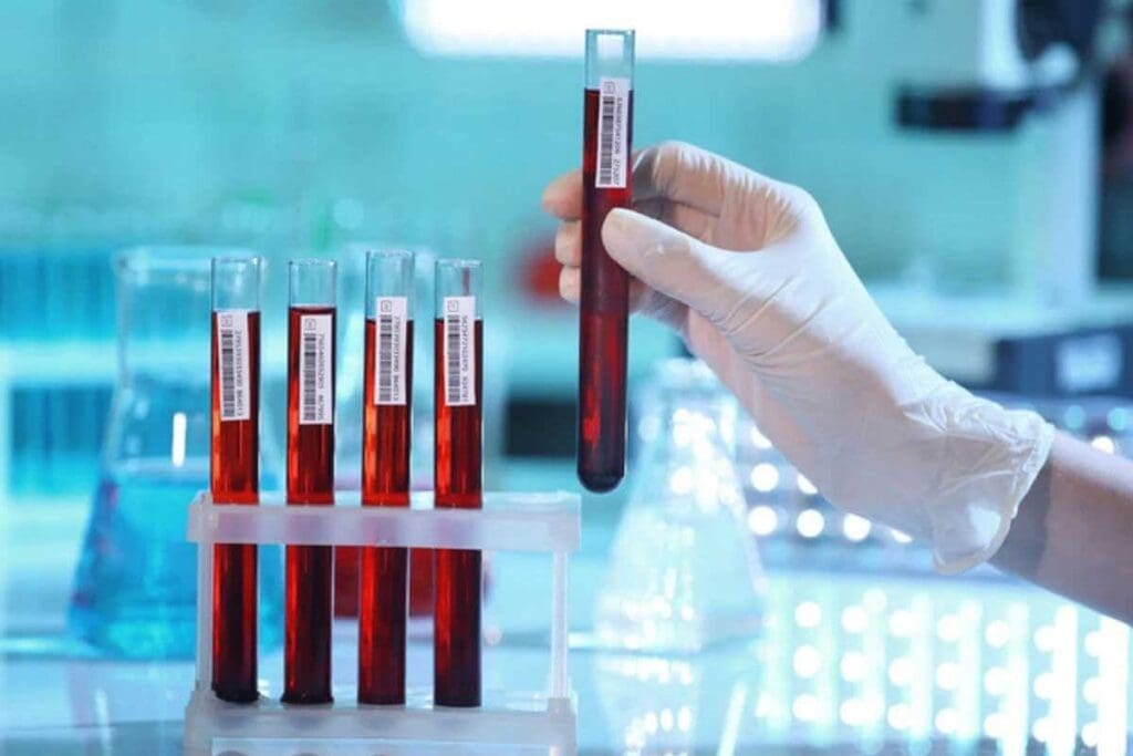 Full Panel Blood Test: 12 Key Markers for General Health Assessment 1 Full Panel Blood Test: 12 Key Markers for General Health Assessment