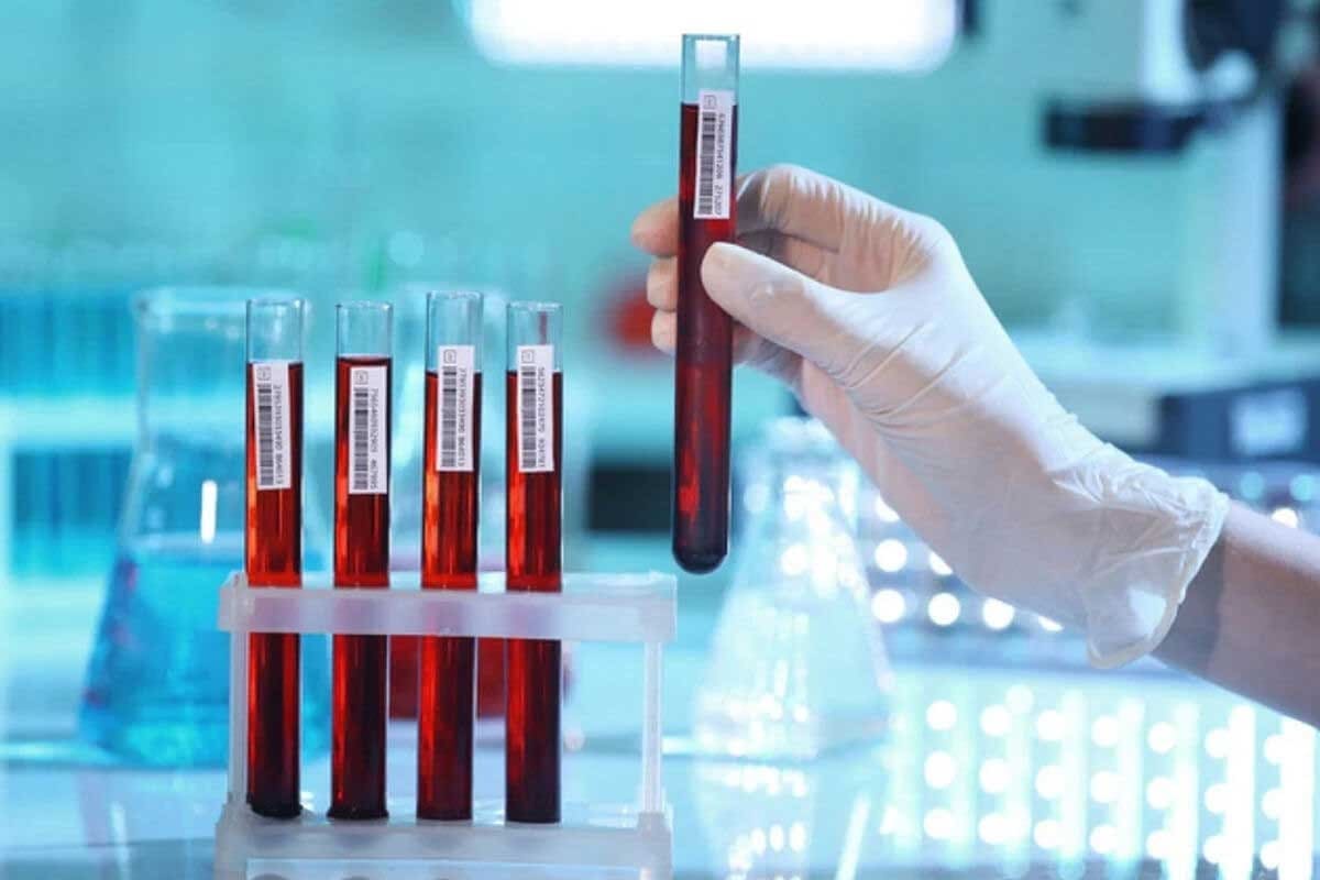 Full Panel Blood Test: 12 Key Markers for General Health Assessment