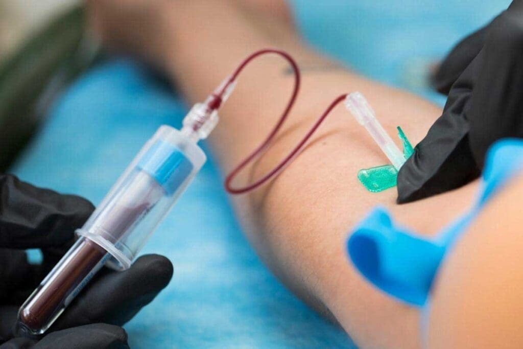 Full Panel Blood Test: 12 Key Markers for General Health Assessment 3 Full Panel Blood Test: 12 Key Markers for General Health Assessment