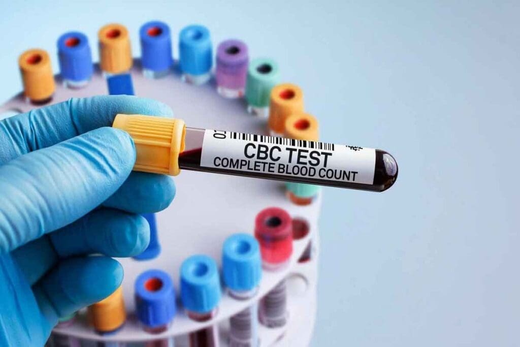 What Can A Blood Test Shows: A Comprehensive Guide