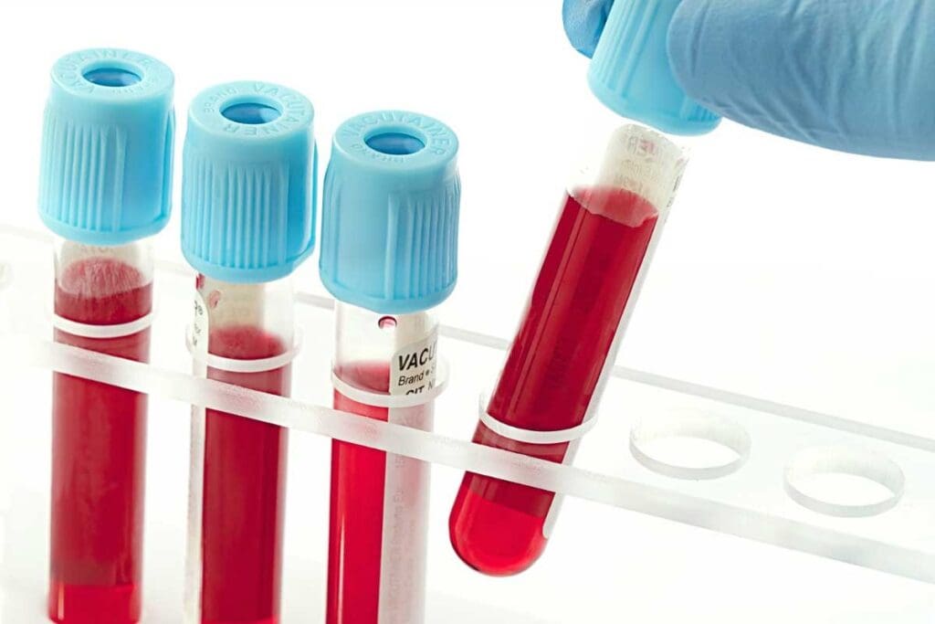 Where To Get a Blood Test: Labs & Procedures Explained 3 Where To Get a Blood Test: Labs & Procedures Explained