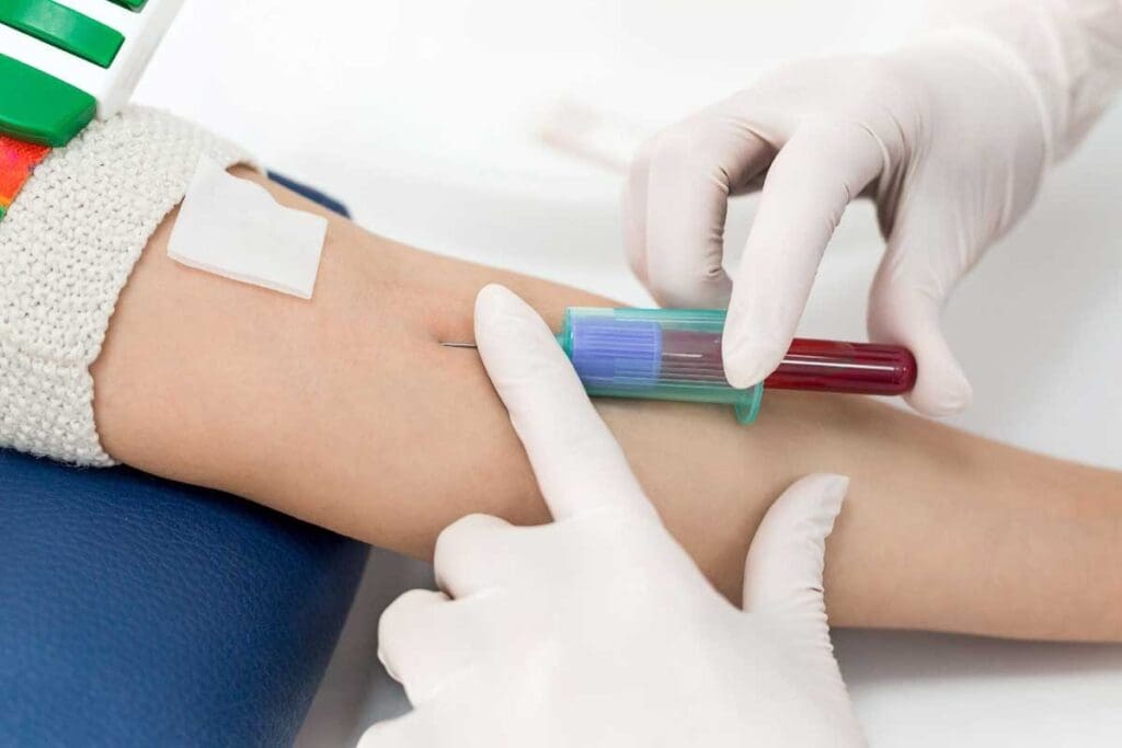 What Can Blood Tests Reveal—and How Do Doctors Use Them for Diagnosis?