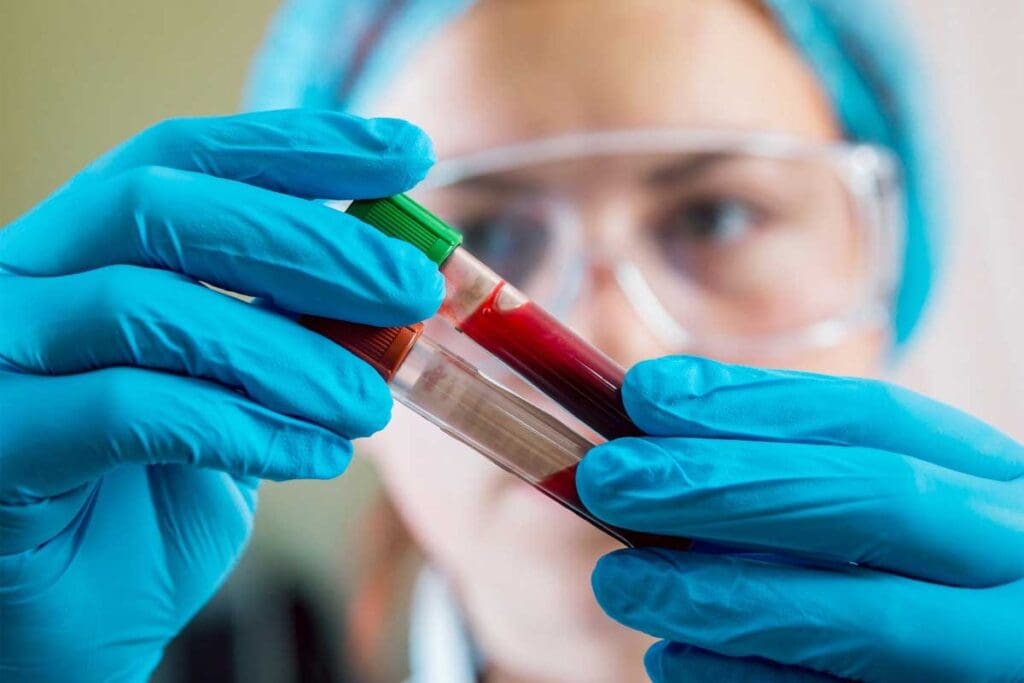 What Can Blood Tests Reveal—and How Do Doctors Use Them for Diagnosis?